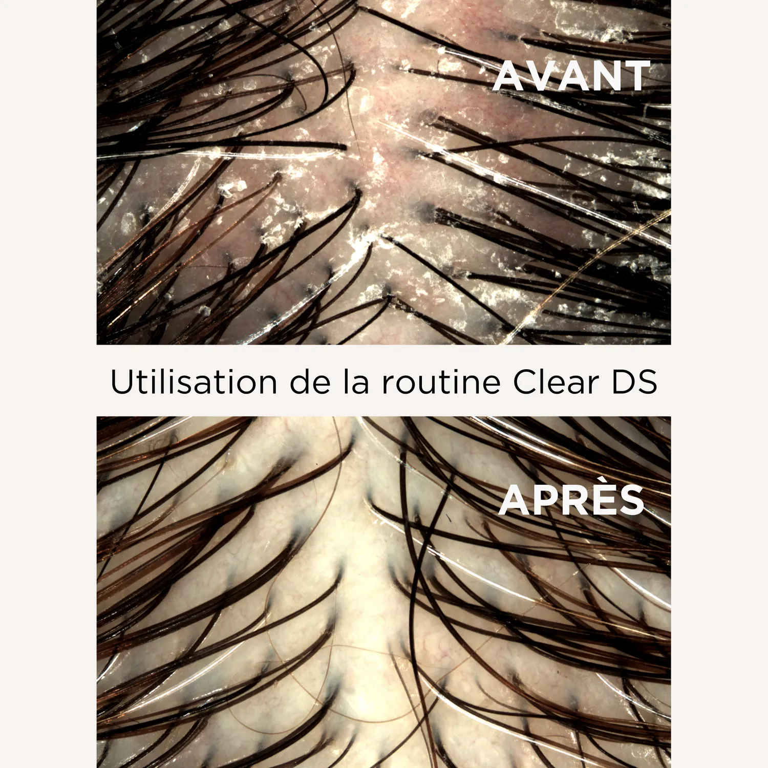 Lazartigue Clear DS hårgelé mot flass