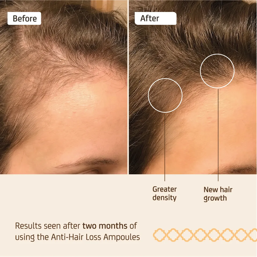 Nuggela & Sulé Anti-Hair Loss hårampuller 10 ml mot hårtap