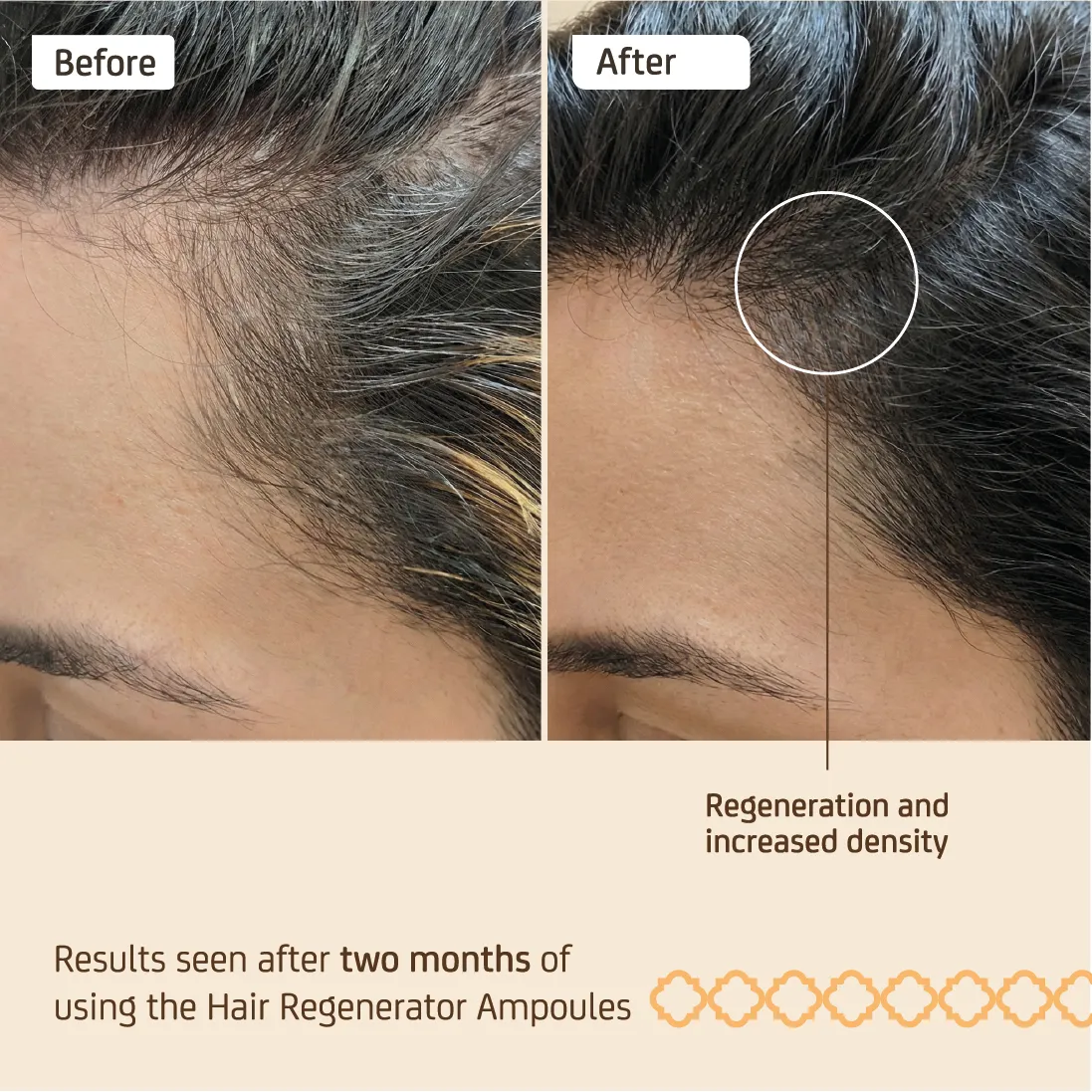 Nuggela & Sulé Hair Regenerator ampuller 4x10 ml